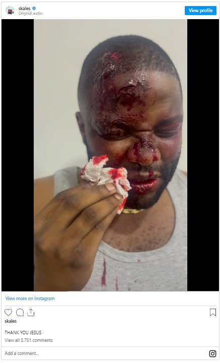 Concern Grows as Skales Appears Bloodied in Viral Video 2 Colleagues and fans express concern as video of Skales covered with bl00d trends